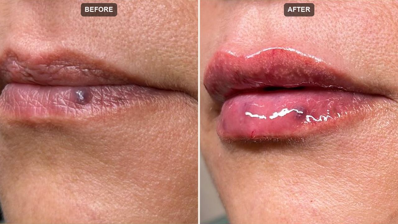 Injectables & Filler