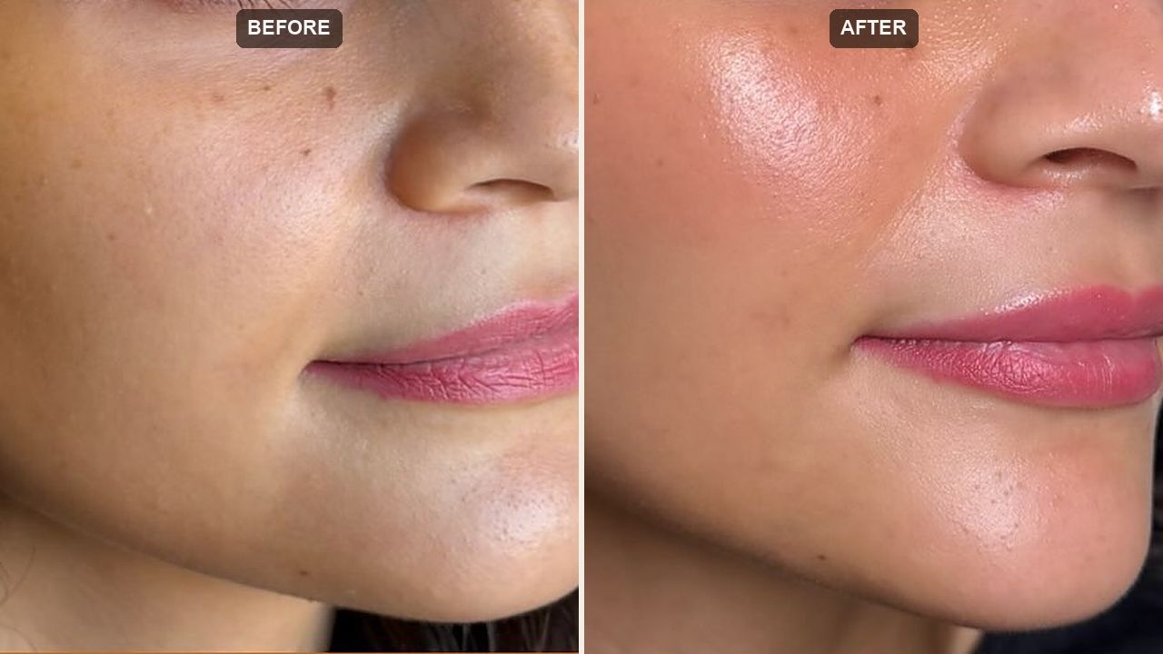 Regenerative Skin